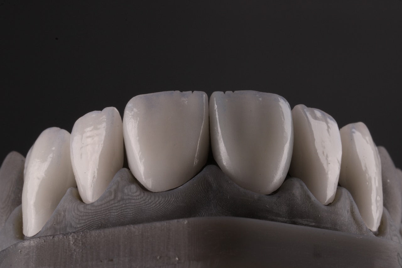 MODELO LAMINADOS CERAMICOS