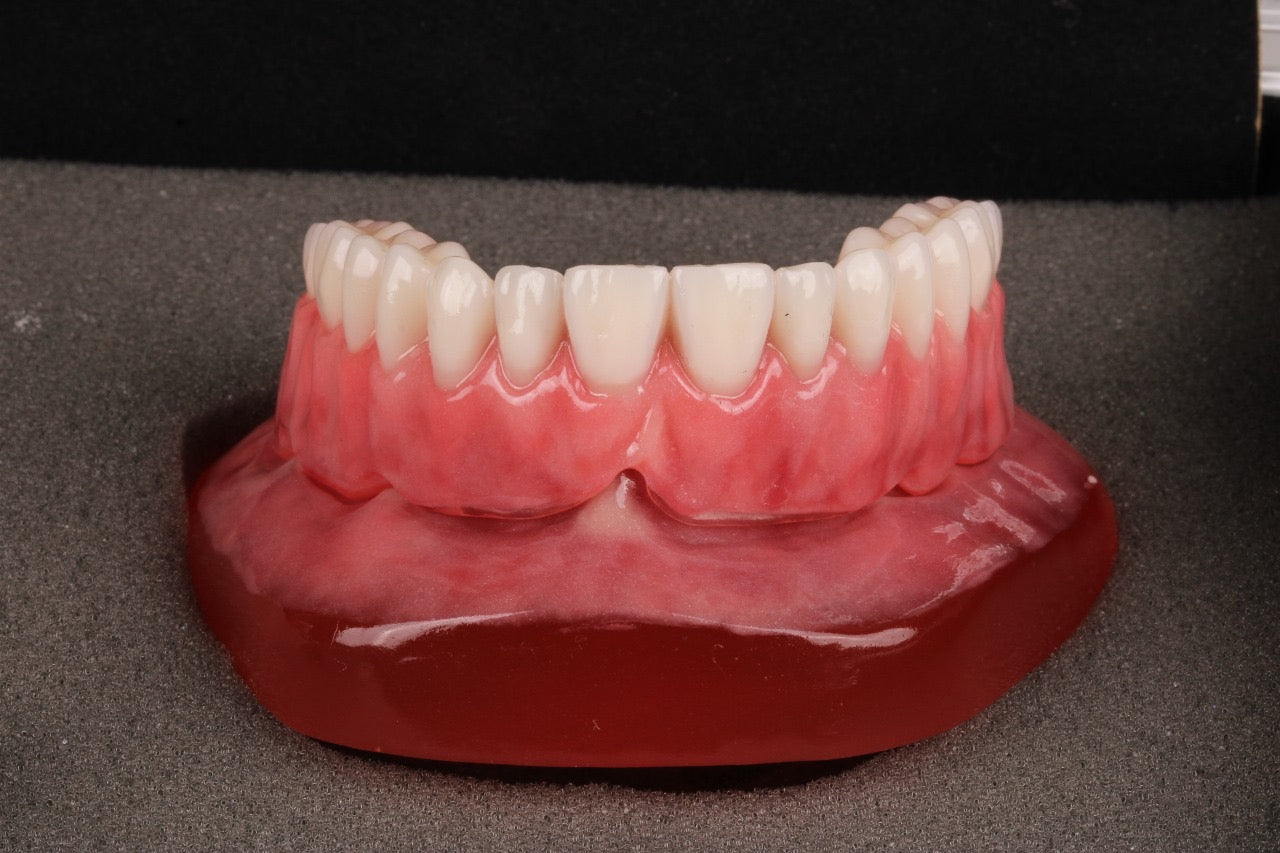 MODELO PRÓTESE TOTAL