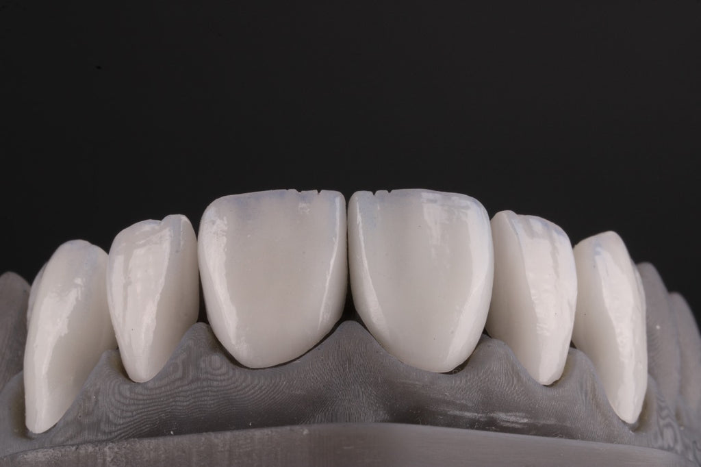 MODELO LAMINADOS CERAMICOS