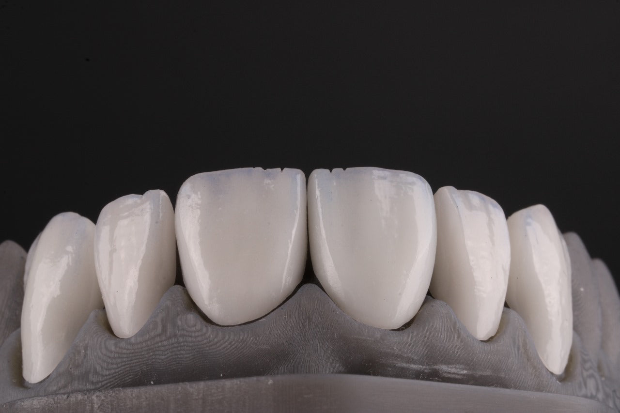 MODELO LAMINADOS CERAMICOS