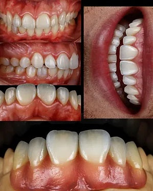 KIT 8 - CÂMERA CANON T7 + LENTE MACRO CANON EF 100MM + TWIN GODOX MF-12 + BLACKOUT - GARANTIA DE FÁBRICA