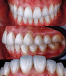 KIT GUMA 3 - GUMA TWIN + FLASH MF12  TWIN GODOX P/CANON OU NIKON ( GARANTIA DE FÁBRICA )