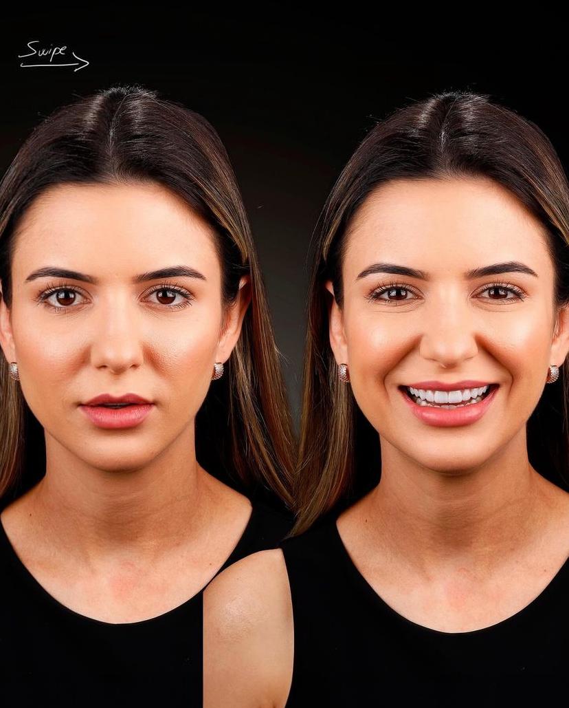 KIT 16 - CÂMERA PROFISSIONAL R100 MIRRORLESS + LENTE MACRO CANON RF 85MM + EST. FOTOGRÁFICO + FLASH YONGNUO