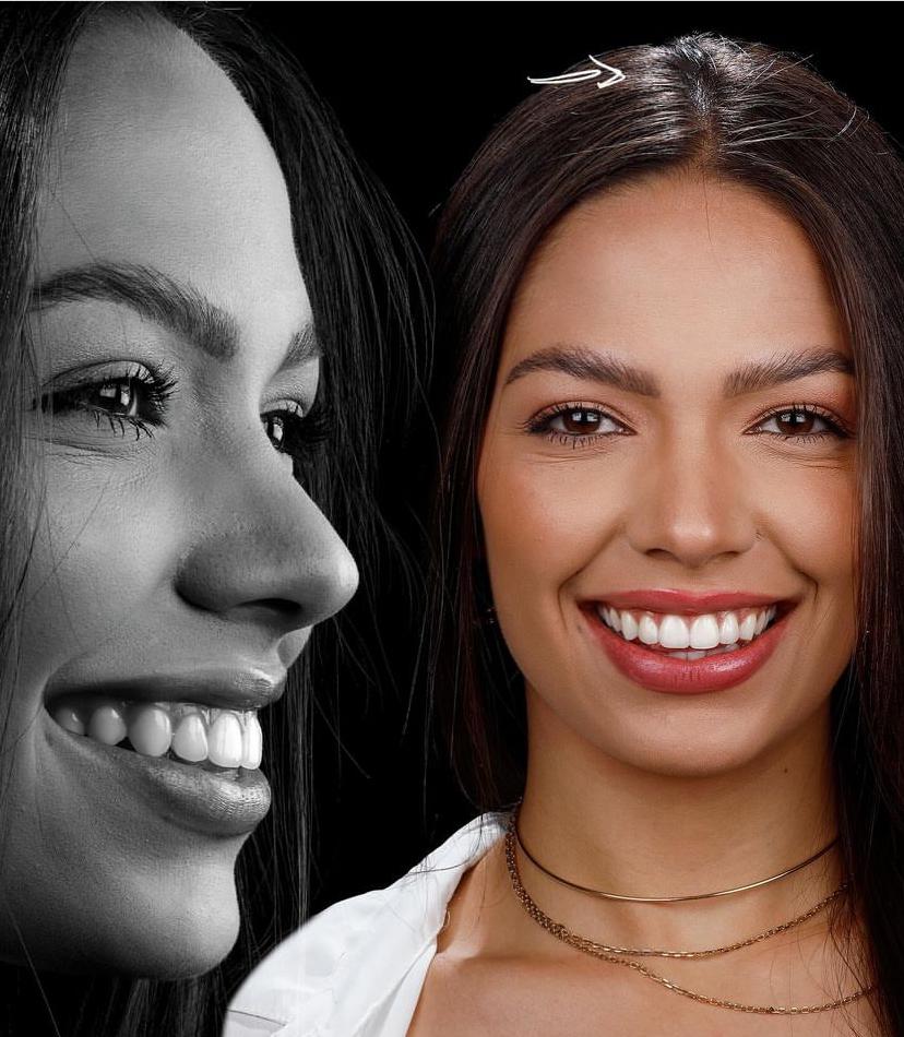 KIT FOTOGRÁFICO PROF. 500W  +  AULA DE MONTAGEM BÔNUS + LÂMP. EM MODELAGEM EM LED. + BLACKOUT SLIM.