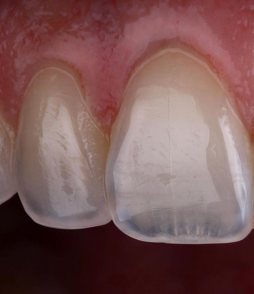 KIT 16 - CÂMERA PROFISSIONAL R100 MIRRORLESS + LENTE MACRO CANON RF 85MM + EST. FOTOGRÁFICO + FLASH YONGNUO