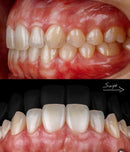 KIT GUMA 3 - GUMA TWIN + FLASH MF12  TWIN GODOX P/CANON OU NIKON ( GARANTIA DE FÁBRICA )