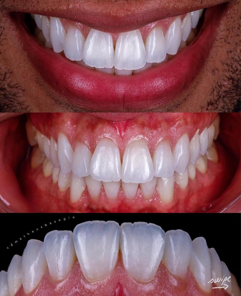 KIT 9- CÂMERA PROFISSIONAL R100 MIRRORLESS + LENTE MACRO CANON 85MM OU RF 100MM + FLASH TWIN YONGNUO YN24EX