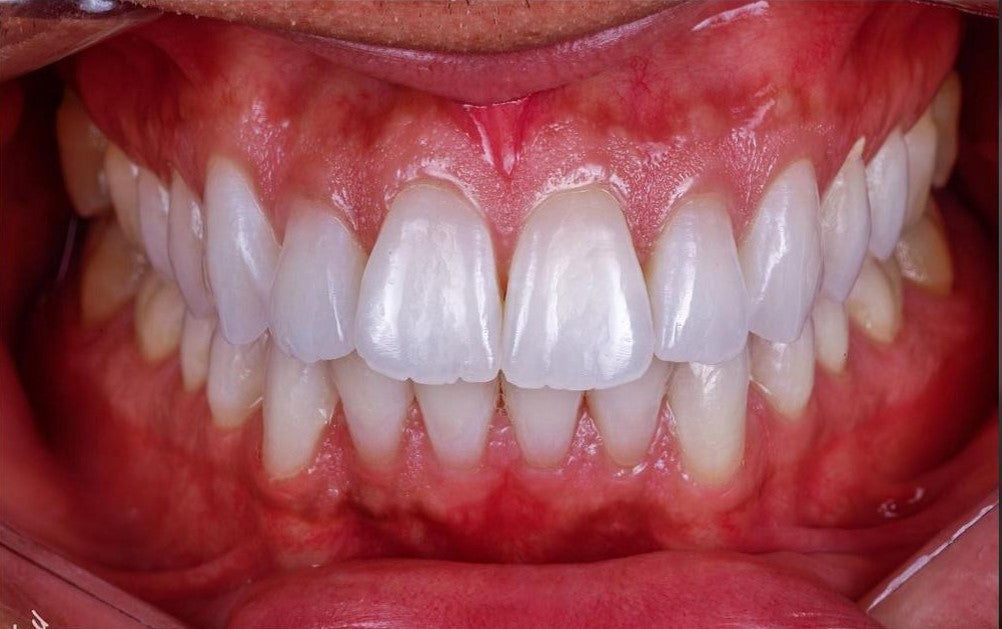 KIT 7 CÂMERA PROF. R100 + ESTÚDIO FOTOGRÁFICO + KIT MACRO ( GARANTIA DE FÁBRICA )