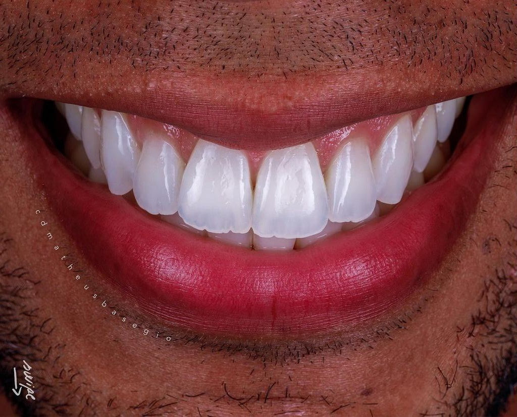 KIT 2 - CÂMERA R100 + KIT MACRO + TWIN YONGNUO ORIGINAL ( GARANTIA DE FÁBRICA )