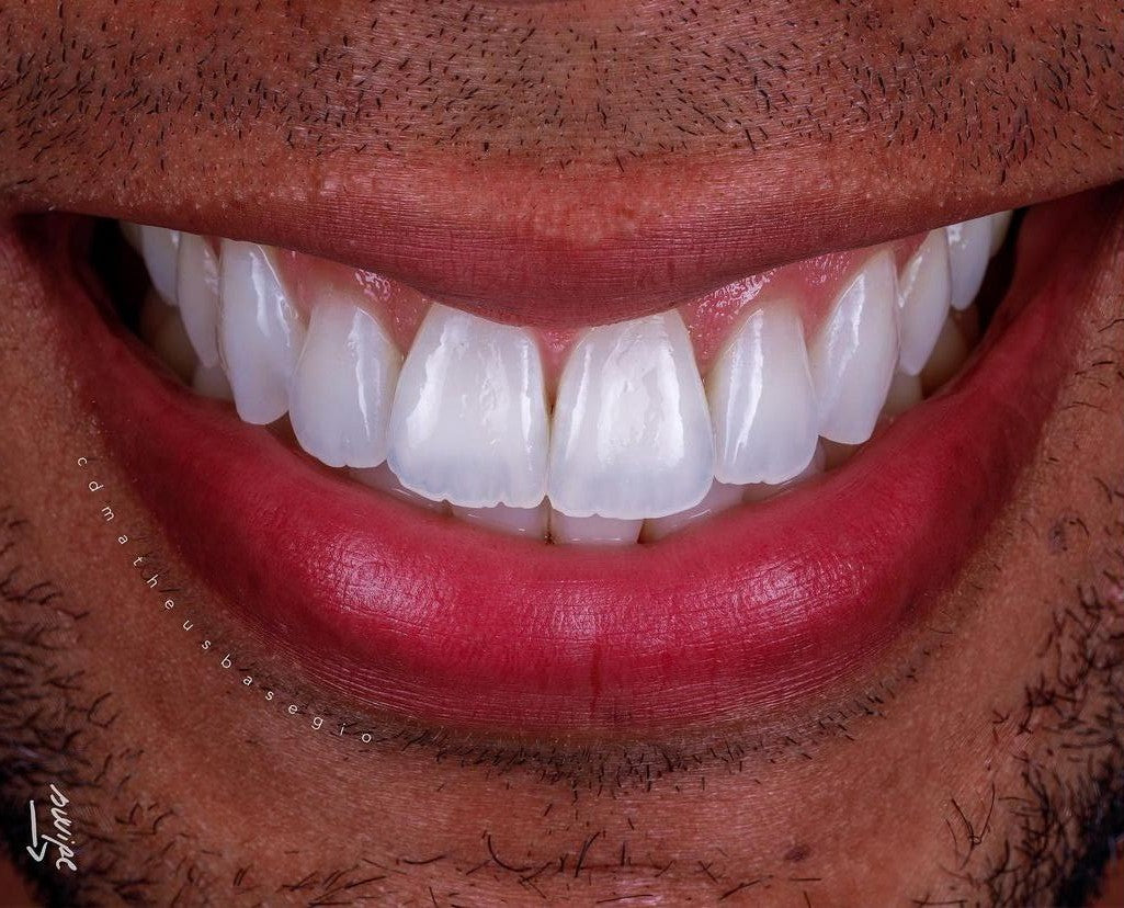 KIT 2 - CÂMERA R100 + KIT MACRO + TWIN YONGNUO ORIGINAL ( GARANTIA DE FÁBRICA )