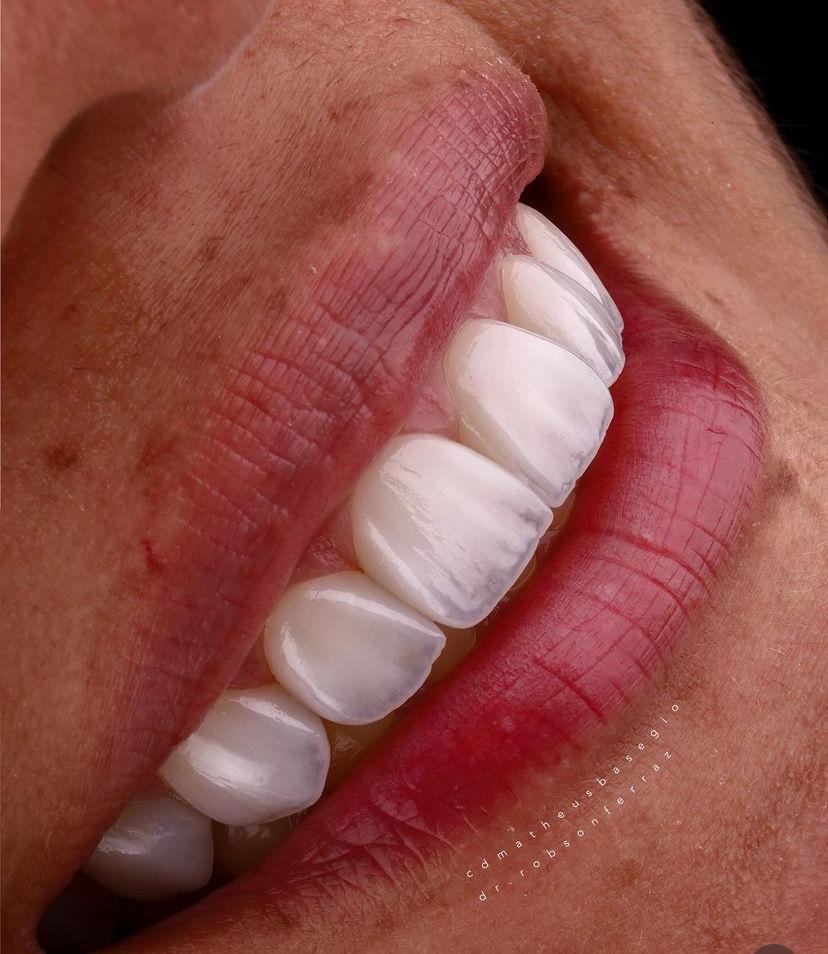 KIT 14 CÂMERA PROFISSIONAL R100 MIRRORLESS + LENTE MACRO CANON RF 85MM + ESTÚDIO FOTOGRÁFICO