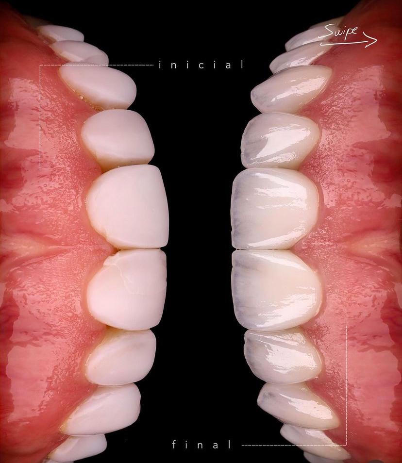 KIT 18 - CÂMERA PROFISSIONAL R100 MIRRORLESS + LENTE MACRO CANON RF 100MM + ESTÚDIO FOTOGRÁFICO + FLASH TWIN GODOX MF-12