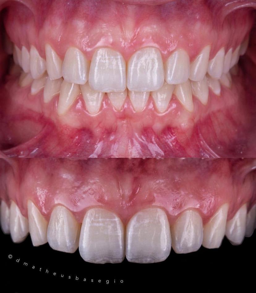 KIT 18 - CÂMERA PROFISSIONAL R100 MIRRORLESS + LENTE MACRO CANON RF 100MM + ESTÚDIO FOTOGRÁFICO + FLASH TWIN GODOX MF-12