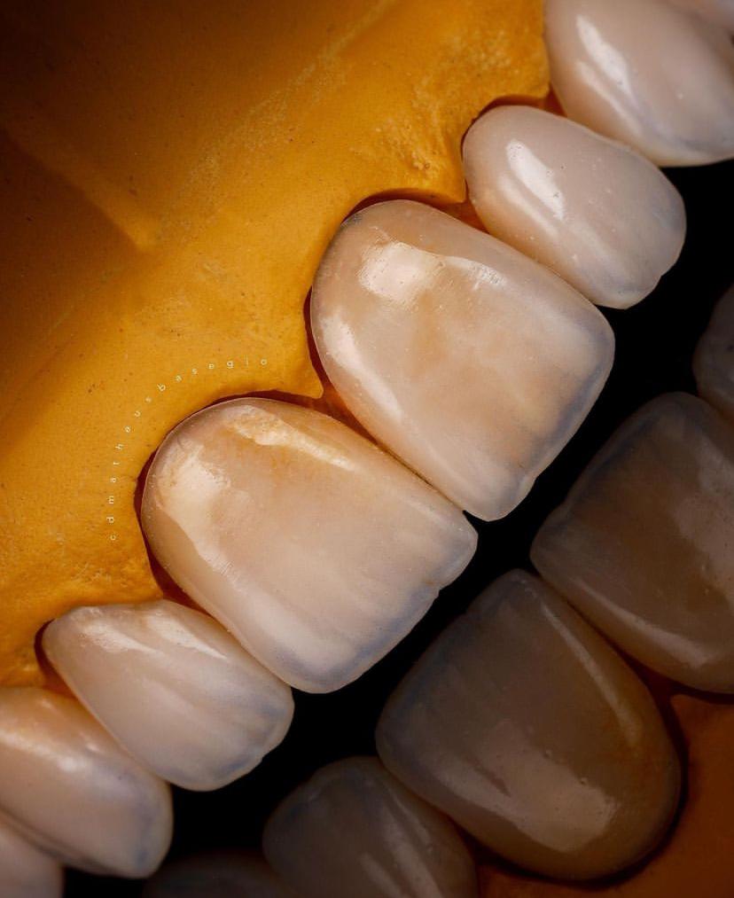 KIT 2 - CÂMERA R100 + KIT MACRO + TWIN YONGNUO ORIGINAL ( GARANTIA DE FÁBRICA )