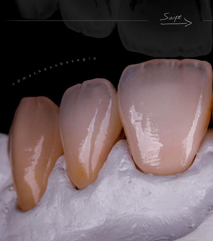 KIT 18 - CÂMERA PROFISSIONAL R100 MIRRORLESS + LENTE MACRO CANON RF 100MM + ESTÚDIO FOTOGRÁFICO + FLASH TWIN GODOX MF-12