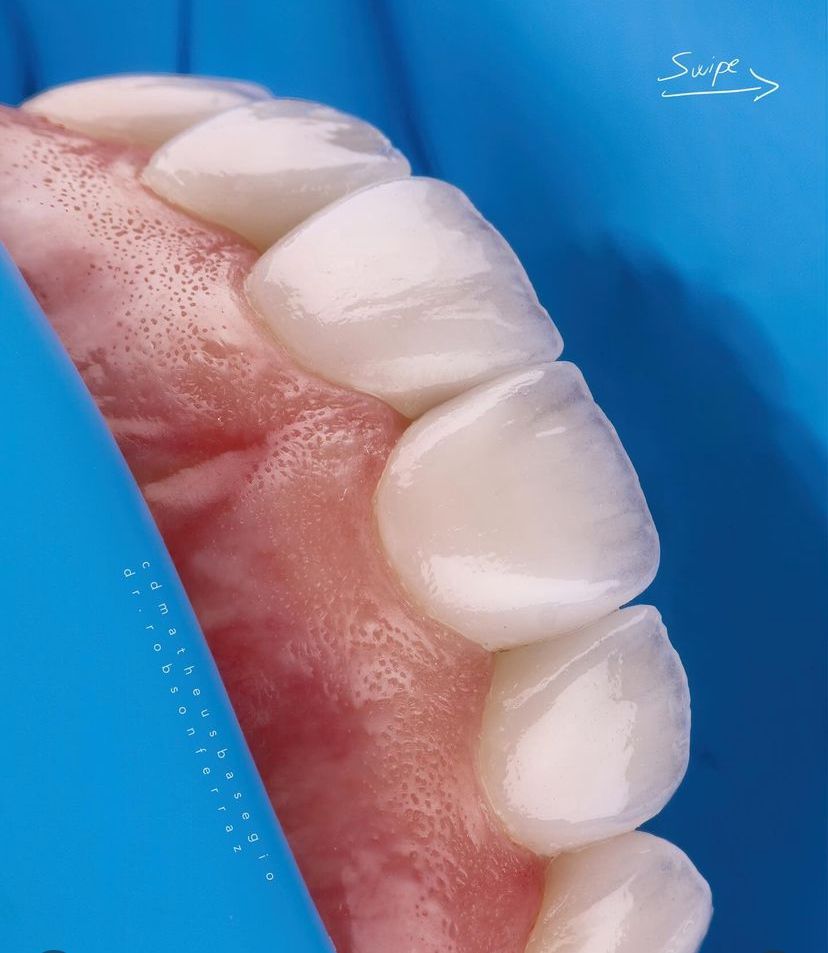 KIT 10- CÂMERA PROFISSIONAL R100 MIRRORLESS + KIT MACRO OU LENTE CANON RF 100MM + TWIN GODOX MF-12 ( GARANTIA DE FÁB.)