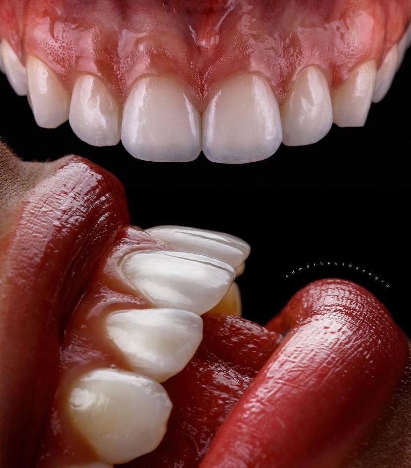 KIT 16 - CÂMERA PROFISSIONAL R100 MIRRORLESS + LENTE MACRO CANON RF 85MM + EST. FOTOGRÁFICO + FLASH YONGNUO