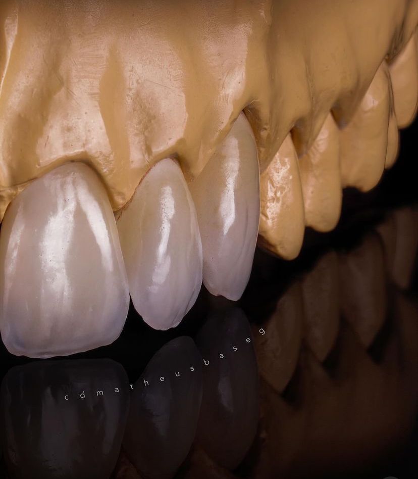 KIT 18 - CÂMERA PROFISSIONAL R100 MIRRORLESS + LENTE MACRO CANON RF 100MM + ESTÚDIO FOTOGRÁFICO + FLASH TWIN GODOX MF-12