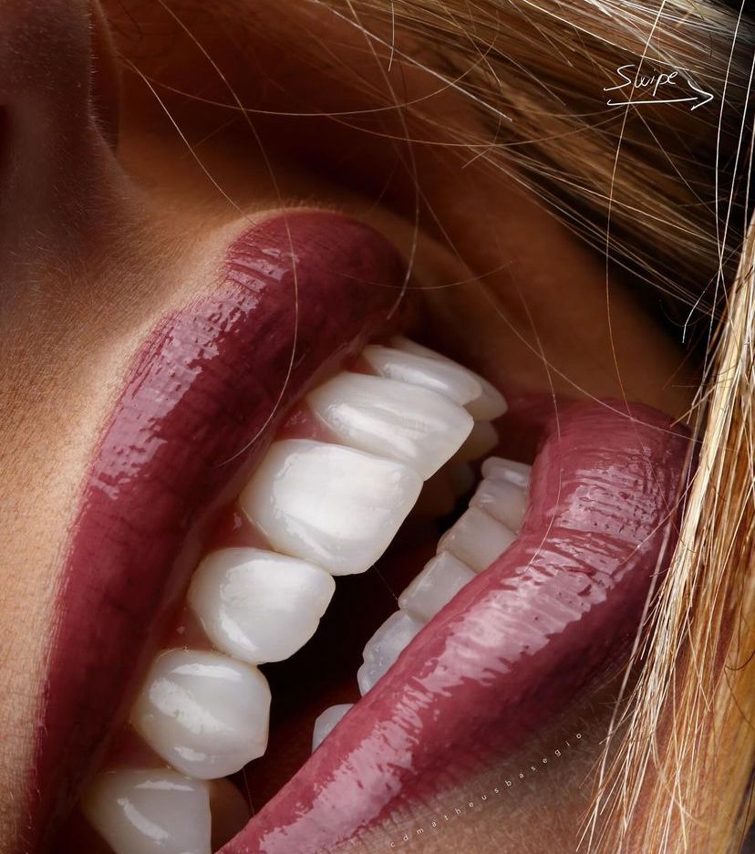 KIT 18 - CÂMERA PROFISSIONAL R100 MIRRORLESS + LENTE MACRO CANON RF 100MM + ESTÚDIO FOTOGRÁFICO + FLASH TWIN GODOX MF-12