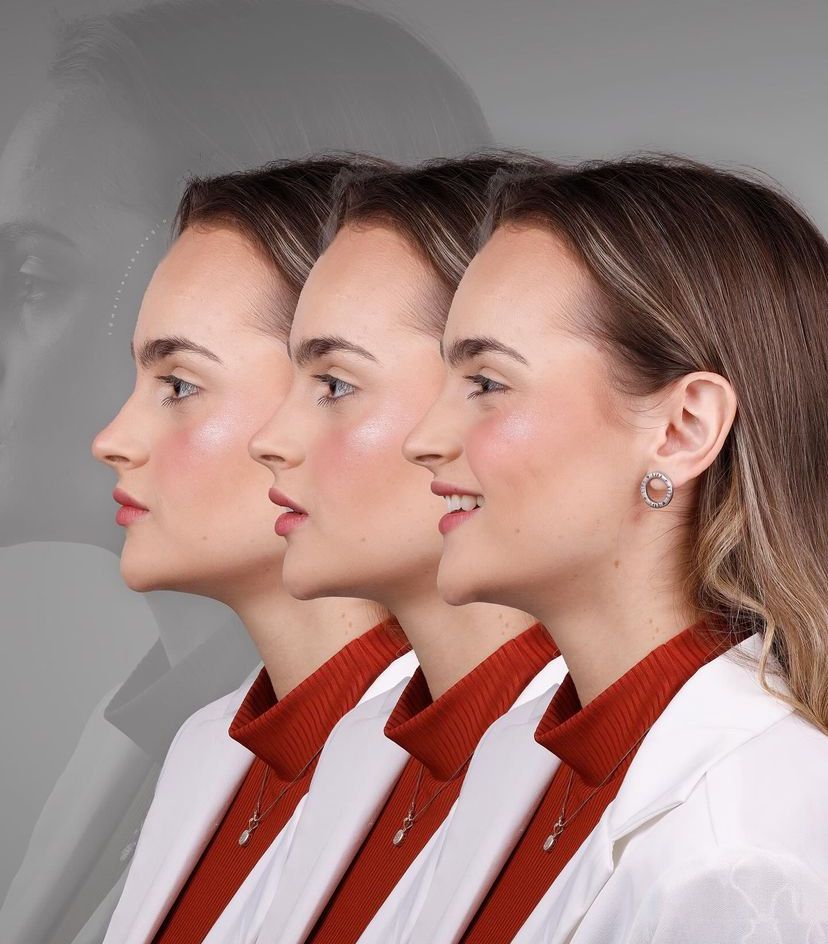 KIT 18 - CÂMERA PROFISSIONAL R100 MIRRORLESS + LENTE MACRO CANON RF 100MM + ESTÚDIO FOTOGRÁFICO + FLASH TWIN GODOX MF-12