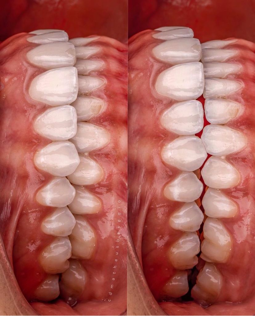 KIT 8- CÂMERA PROFISSIONAL R100 MIRRORLESS + LENTE MACRO CANON 85MM OU RF 100MM +  FLASH CIRCULAR GODOX MF-R76 ( GARANTIA DE FÁBRICA )