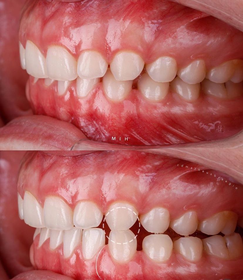 KIT 8- CÂMERA PROFISSIONAL R100 MIRRORLESS + LENTE MACRO CANON 85MM OU RF 100MM +  FLASH CIRCULAR GODOX MF-R76 ( GARANTIA DE FÁBRICA )