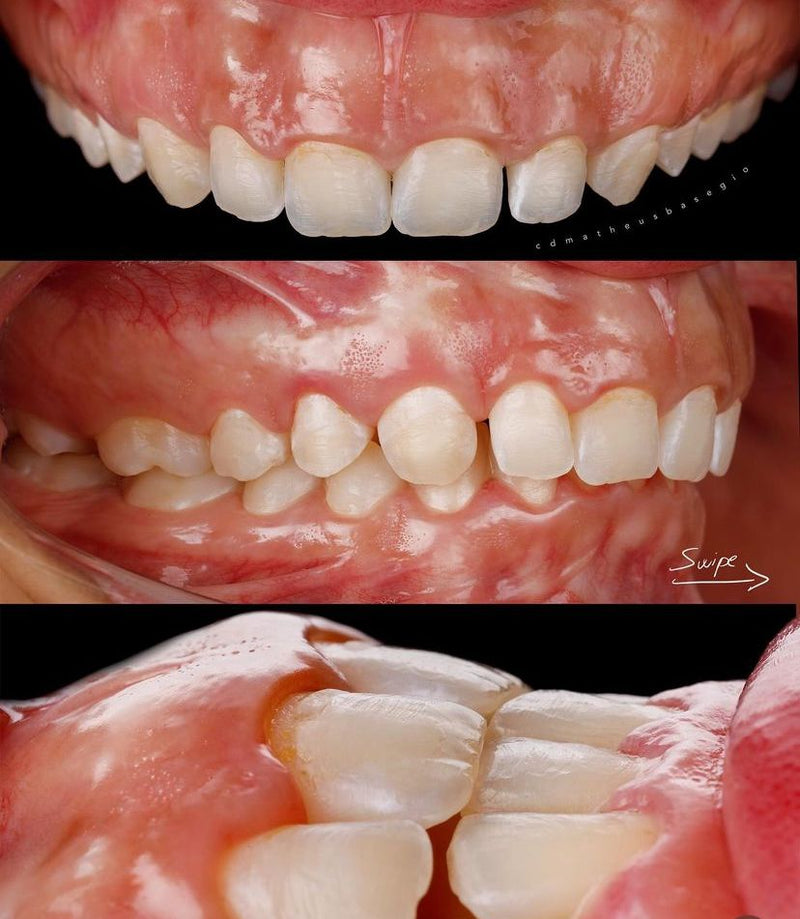 KIT 37-( RADIOLOGIA)  - CÂMERA R100+ / + FLASHRING + LENTE MACRO 100MM RF CANON +  BLACKOUT + PONTO SUPERIOR