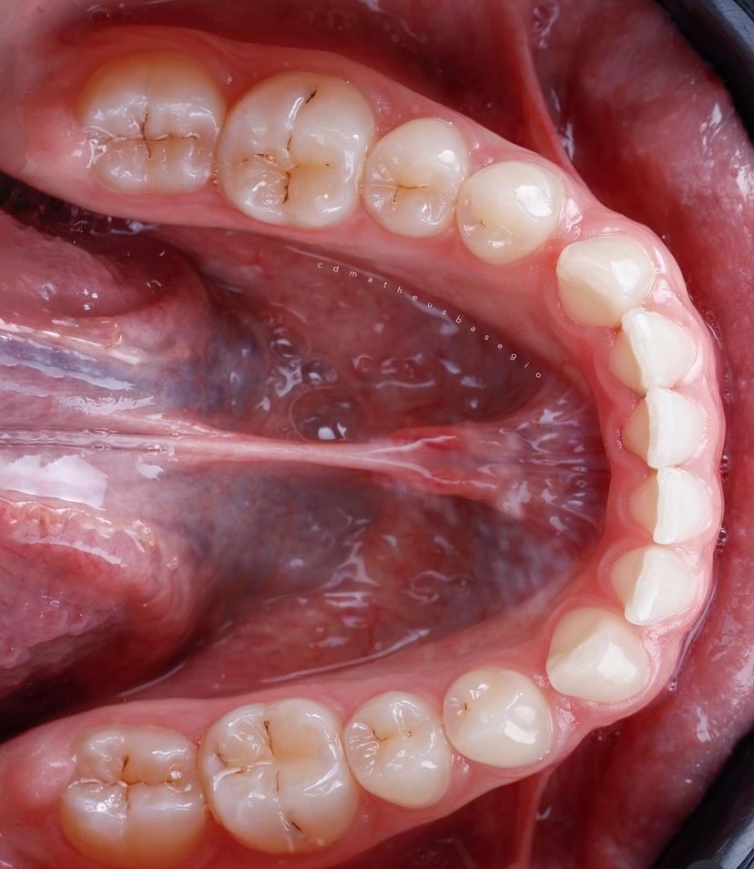 KIT 8- CÂMERA PROFISSIONAL R100 MIRRORLESS + LENTE MACRO CANON 85MM OU RF 100MM +  FLASH CIRCULAR GODOX MF-R76 ( GARANTIA DE FÁBRICA )