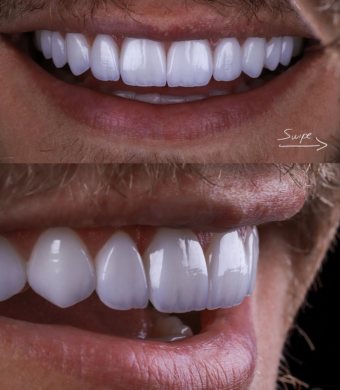 KIT 4 - CÂMERA CANON T7+ KIT MACRO ( TUBO + FILTRO DEDICADO ) + TWIN GODOX MF-12 + BLACKOUT - GARANTIA DE FÁBRICA