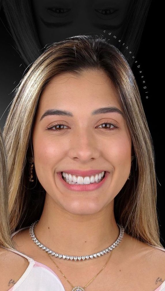 KIT 16 - CÂMERA PROFISSIONAL R100 MIRRORLESS + LENTE MACRO CANON RF 85MM + EST. FOTOGRÁFICO + FLASH YONGNUO