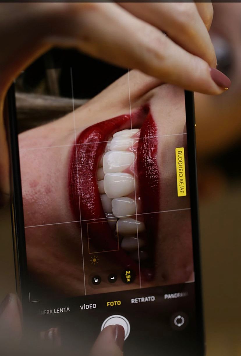 SMARTLIGHT MINI ESTÚDIO ODONTOINFOCO ESPECIAL PARA ODONTO + BÔNUS UM BRINDE ( FUNDO BLACKOUT  ) .