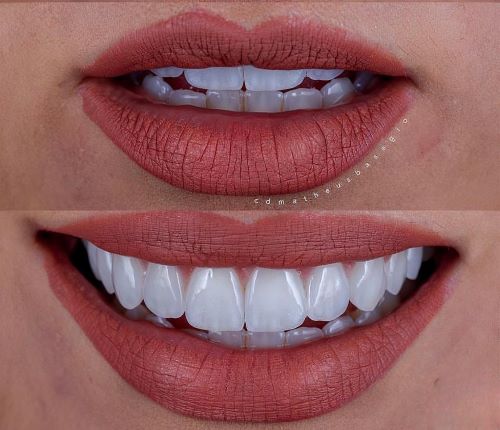 KIT 1 - CÂMERA T7+ KIT MACRO (TUBO + FILTRO DEDICADO) + FLASH CIRCULAR YOUNGNUO + BLACKOUT - GARANTIA DE FÁBRICA!