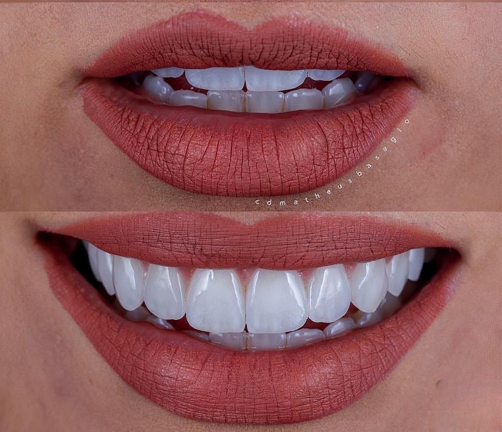 KIT 10- CÂMERA PROFISSIONAL R100 MIRRORLESS + KIT MACRO OU LENTE CANON RF 100MM + TWIN GODOX MF-12 ( GARANTIA DE FÁB.)