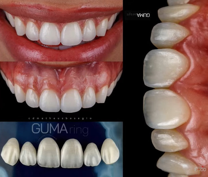 KIT GUMA  2 - GUMA TWIN + FLASH TWIN YONGNUO YN24EX P/CANON