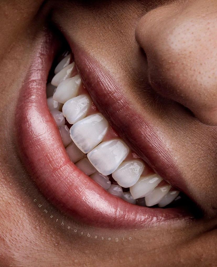 KIT 17 - CÂMERA PROFISSIONAL R100 MIRRORLESS + LENTE MACRO CANON RF 100MM + EST. FOTOGRÁFICO + FLASH YONGNUO