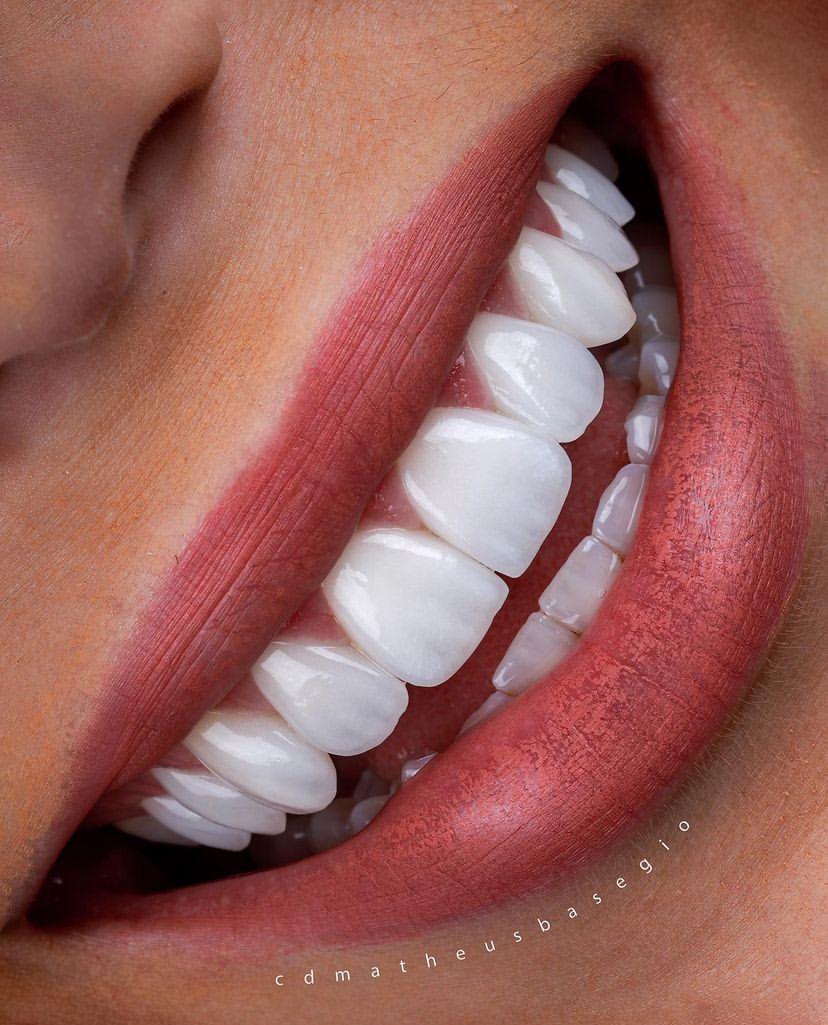 KIT 10- CÂMERA PROFISSIONAL R100 MIRRORLESS + KIT MACRO OU LENTE CANON RF 100MM + TWIN GODOX MF-12 ( GARANTIA DE FÁB.)