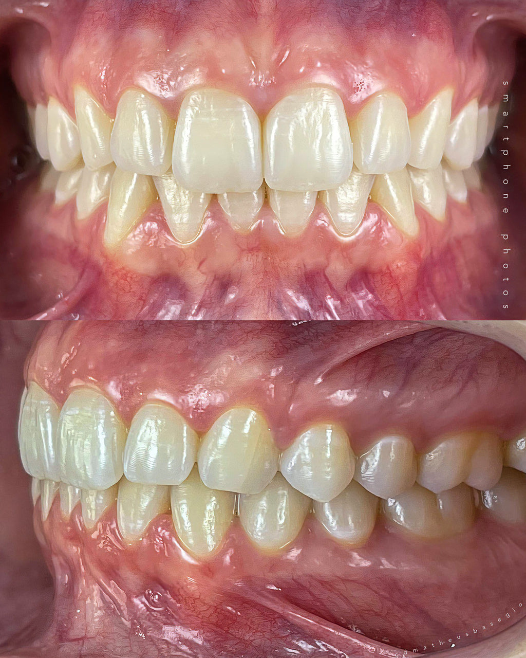 SMARTLIGHT MINI ESTÚDIO ODONTOINFOCO ESPECIAL PARA ODONTO + BÔNUS UM BRINDE ( FUNDO BLACKOUT  ) .